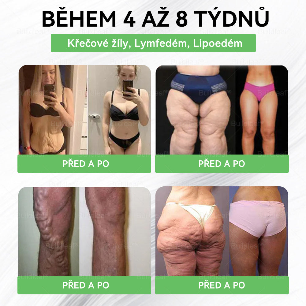 BuildLeaf® GLP-1 8-v-1 Fit & Vital Řešení ✨✨ (Jednou denně, viditelné změny za 7 dní) ✅ Obezita, kardiovaskulární zdraví, cukrovka, spánková apnoe, zdraví střev, problémy se klouby a další.